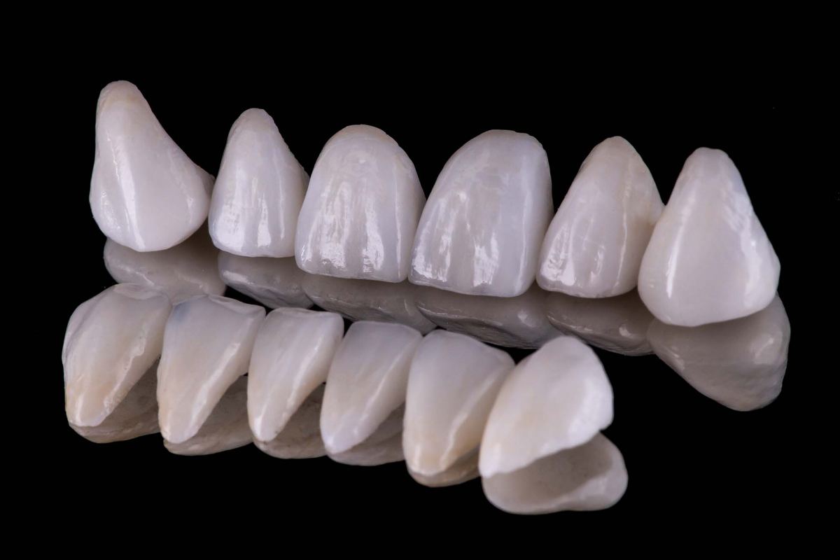 Teeth Veneers Blue Mountains